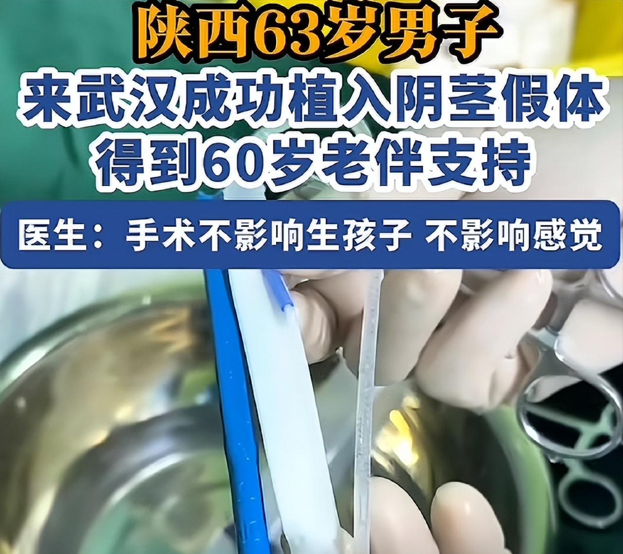 陕西，一63岁男子，因高血压、糖尿病致夫妻生活力不从心，60岁妻子支持其做植入假