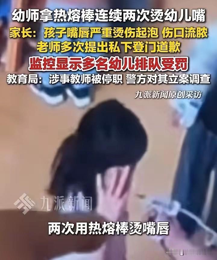 不开除天理难容！近日江苏徐州丰县一家长反应，孩子的嘴唇有灼伤痕迹，以为她是喝开