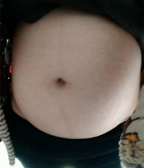 孕妇患产后抑郁症, 导致宝宝缺氧送医抢救, 娘家人连扇女婿耳光