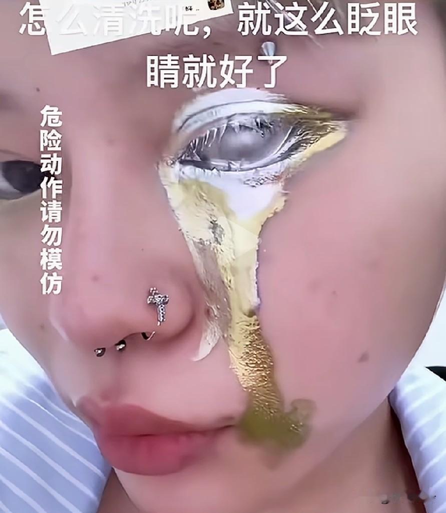 看着好吓人啊！这眼睛还能救吗？女子用银粉化妆，称清洗时不停眨眼睛就好了，这可是