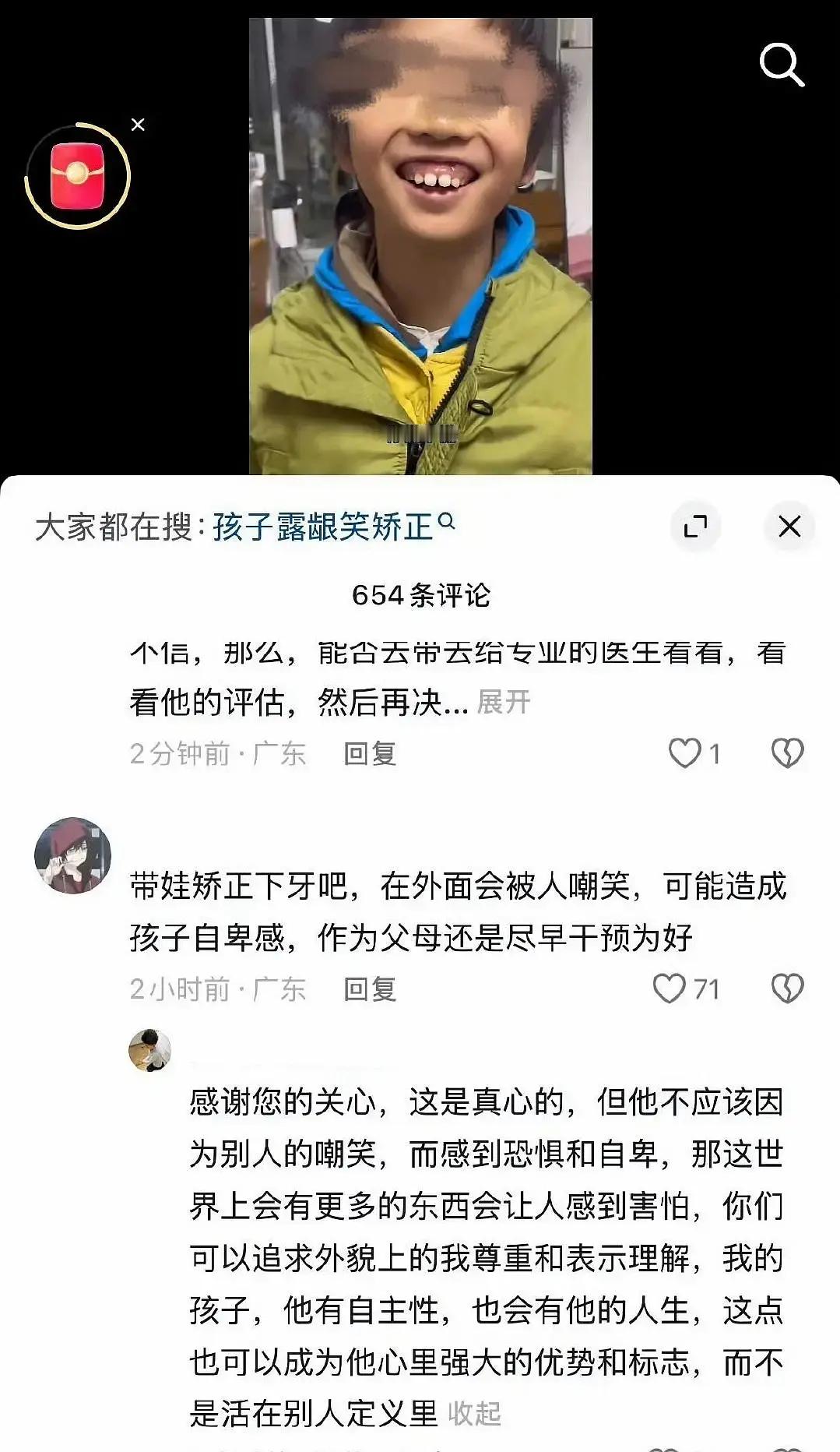 网友劝人带孩子矫正一下牙齿回复……孩子天崩开局