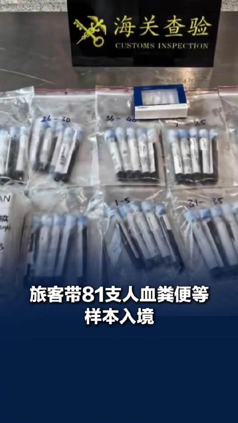 好险！境外人体组织被查，差点通过海关入境，81支人体的血液、粪便、血清塞在一个行