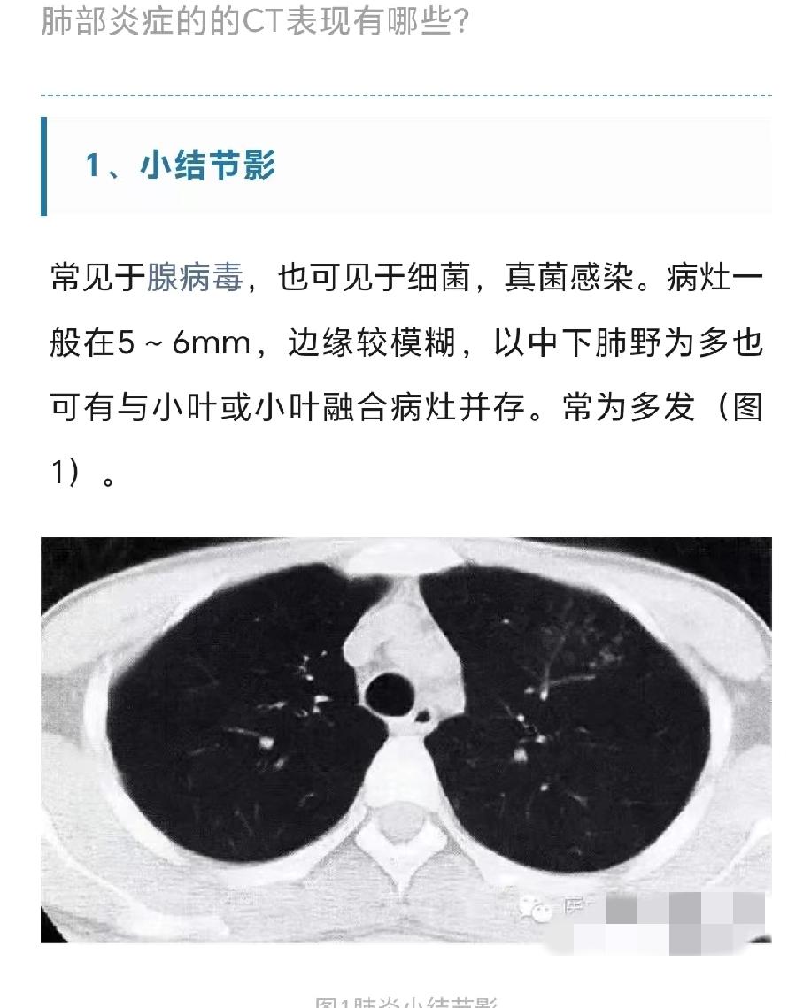 肺部感染：发热较为常见，体温可能较高，而且发热持续时间相对较长，可出现持续性发热