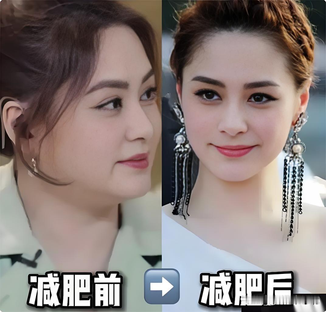 演员阿娇瘦10斤差距有多大？减肥前后判若两人，你们更喜欢哪种状态？