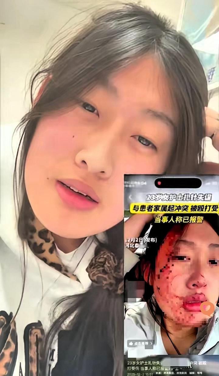 万万没想到！秦皇岛“护士被打”居然是场彻头彻尾的骗局！之前刷到满脸是血的哭