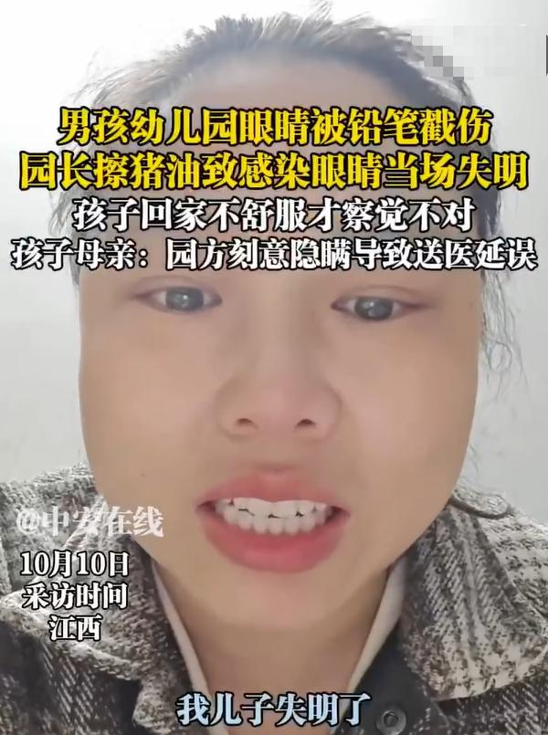 孩子眼睛被铅笔戳伤，幼儿园园长居然往伤口上抹猪油？这是什么“黑偏房”！现在孩子已