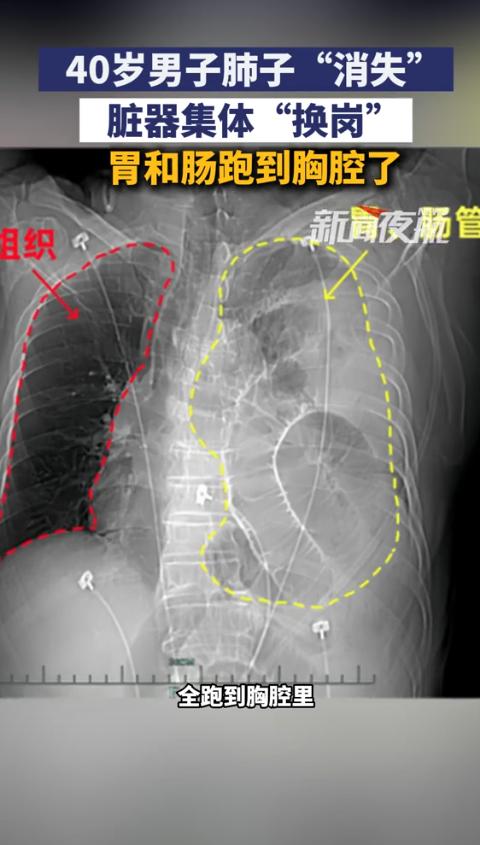 “这就是命！”浙江，一男子参加活动抽奖，意外中奖获得了一次免费体检的资格，可体检