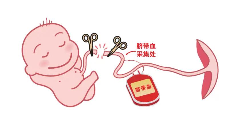 婴儿出生时的脐带血是否有必要保存？这一问题需要结合医学价值、经济成本和实际需求综