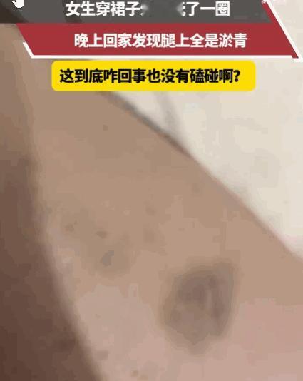 真是没想到！河南，一女生身穿裙子外出游玩，然而，当晚回到家后，她惊恐地发现自己双