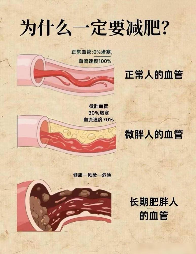 为什么一定要控制体重，这就是原因为什么一定要减重？我去年体检查出血压边缘