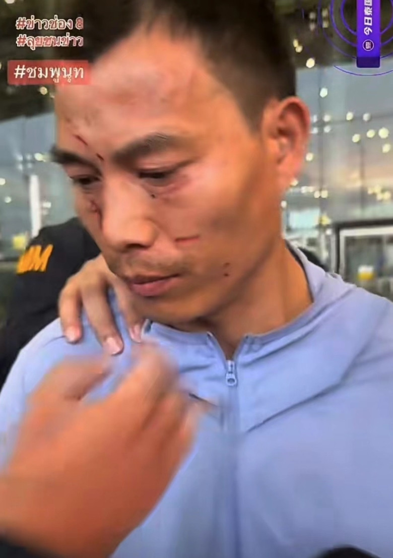42岁湖北籍男子在泰国春武里府芭提雅买春遭遇变形人，因交易纠纷对泰国变性人虐杀，
