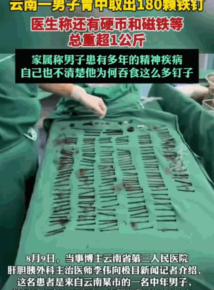 太吓人了！云南，一男子连续9天呕吐、腹痛送医，医生看完片子当场倒吸一口凉气：他肚