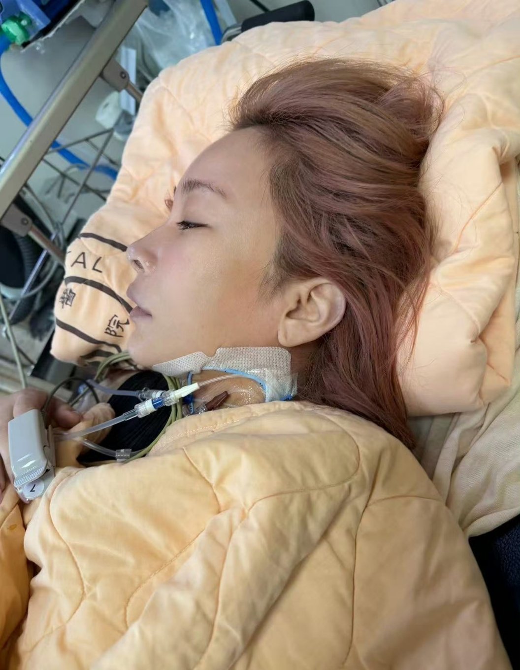 温岚在ICU抢救了10天多多保重身体吧，没有什么能比身体健康更重要了，愿平安
