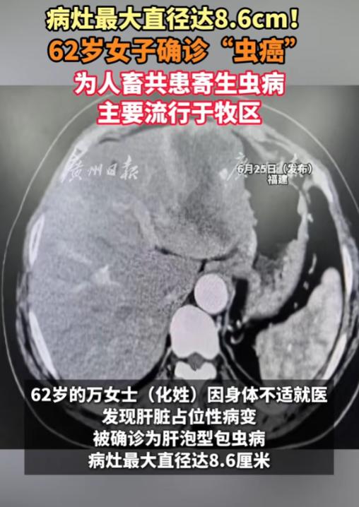 “人和宠物还是要分清楚！”6月25日，福建，一位62岁的女子身体不适到医院检查，