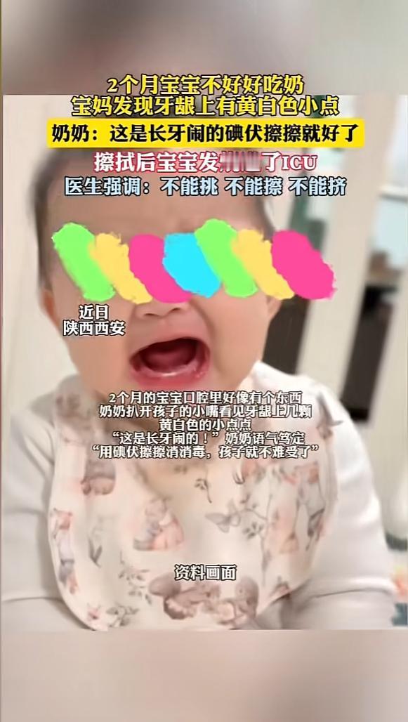 “悲剧还是发生了！”近日，陕西西安，一女子发现自家孩子牙龈上有几颗黄白小点，孩子