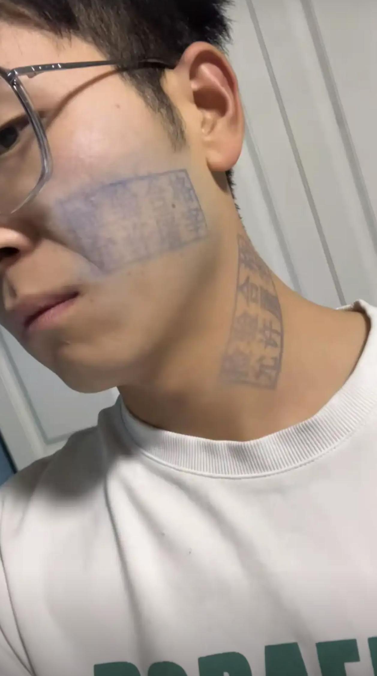 我有个朋友，昨天跟个杀猪的起了冲突，没干过也就算了，脸和脖子上还被人盖了俩猪肉检