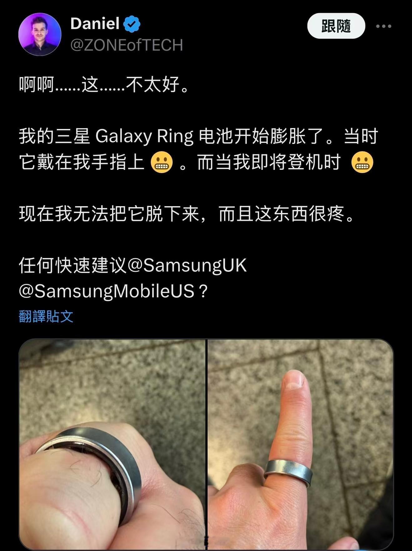 电池出问题算是三星传统艺能了，不过这鼓包看起来蛮痛的​​​