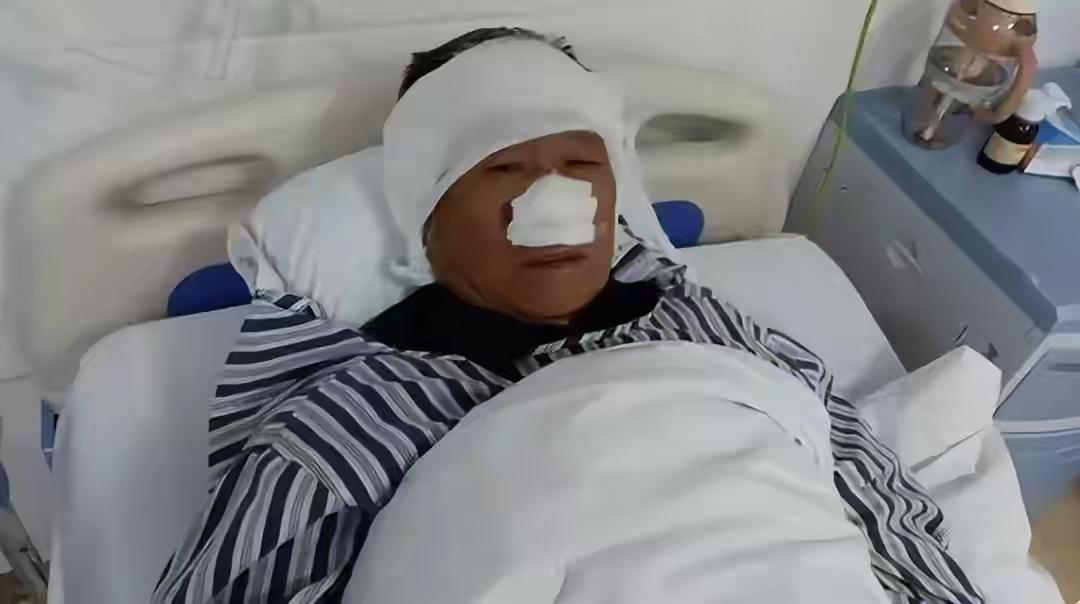 70岁老人仗义救人，被施暴者男子咬掉鼻子，吞入肚子。事发地郴州嘉禾，一男子四处砸