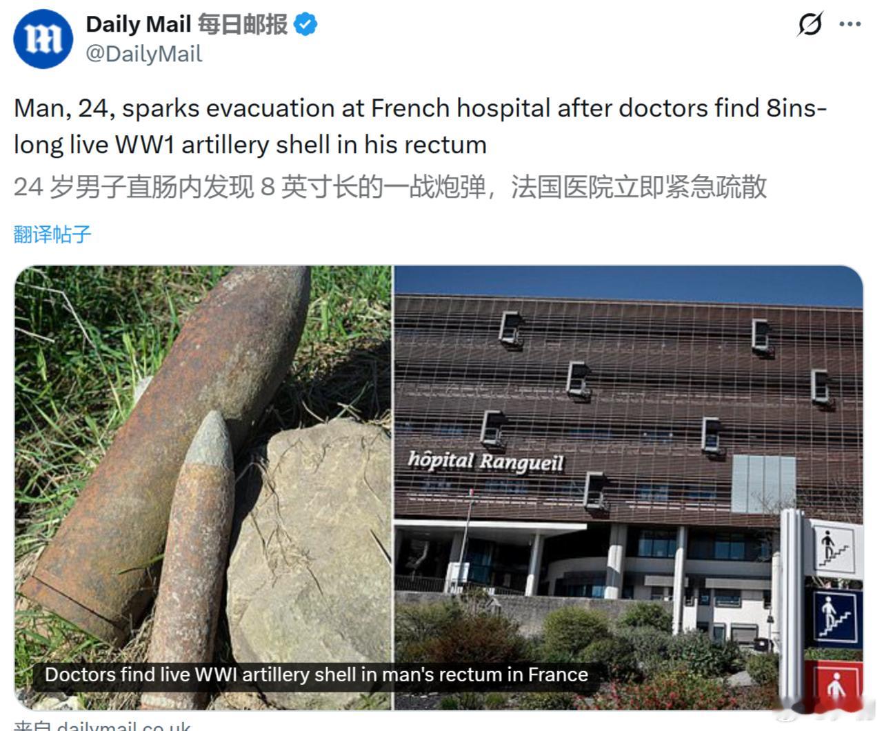 《每日邮报》：法国一名24岁男子，因为腹痛住进住进医院，医生在他的直肠内发现一枚