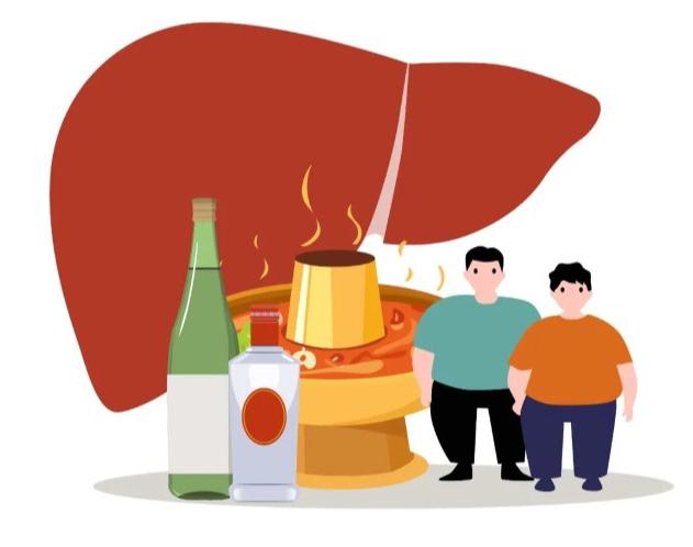 查出脂肪肝，到底要不要管？体检报告上“脂肪肝”三个字，十个人有八个不当回