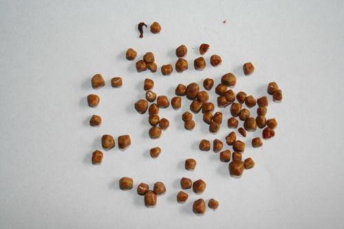 男子身体里取出44颗结石, 医生警告: 菠菜别和它一起吃