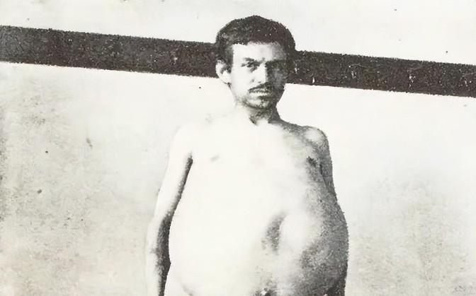 1940年，一位美国男子正在排泄大便时突然死亡，当法医检查过后发现男子体内竟然堆
