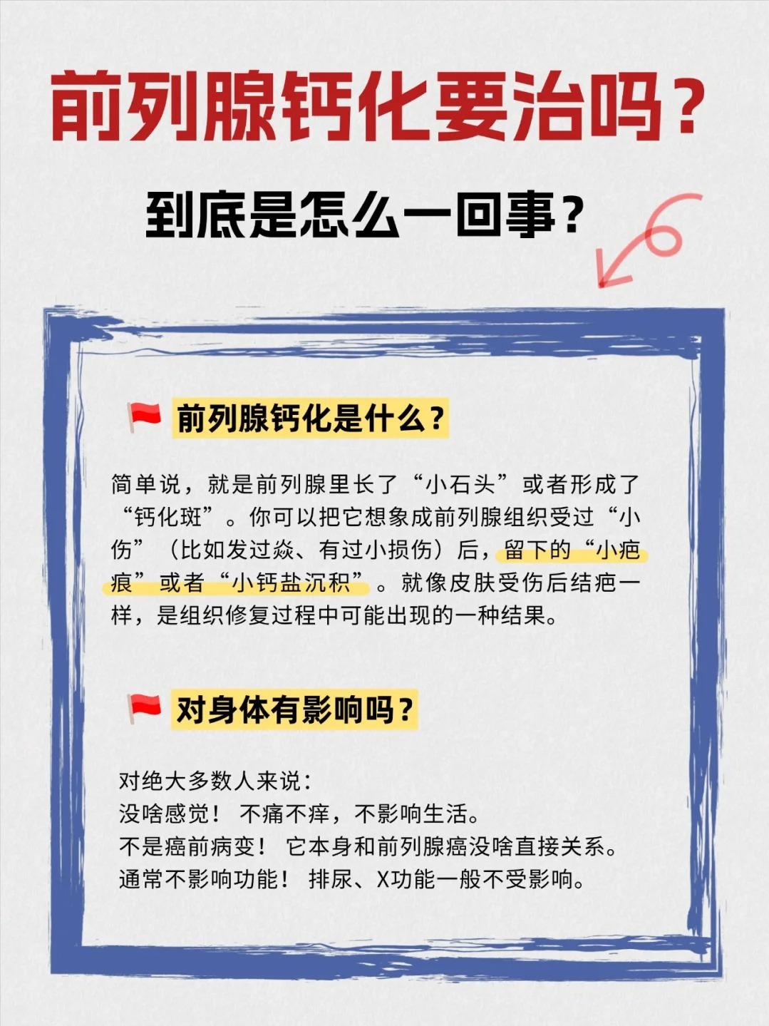 前列腺钙化是病吗？到底要不要紧？请仔细看