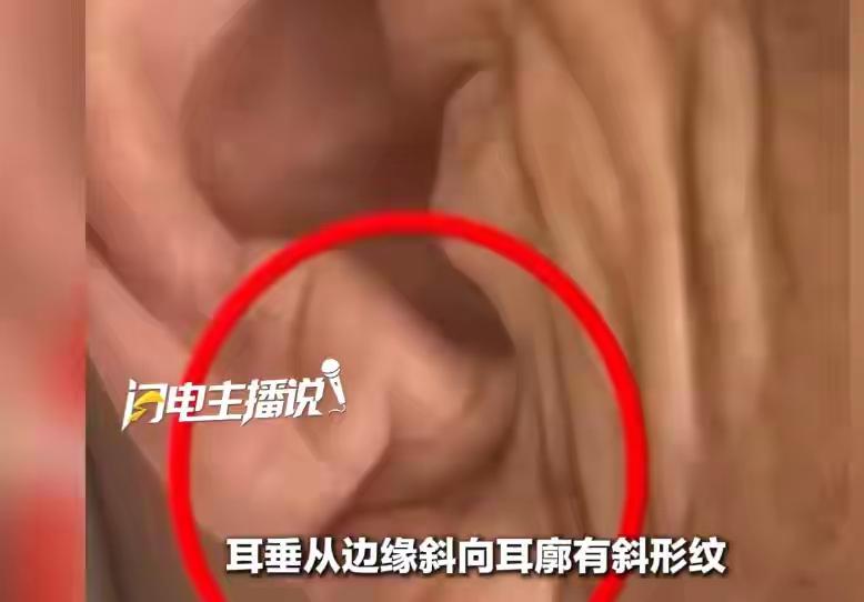 这医生，真的是救命的活菩萨[赞][赞]近日，江苏南京一名70多岁的男子，老伴