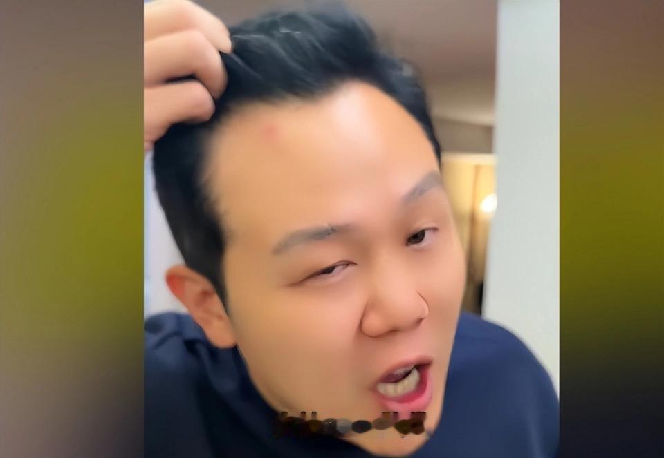中国球迷墨西哥惊魂12小时！落地半小时枪顶脑门，遭“飞车党”抢劫，劳力士、现