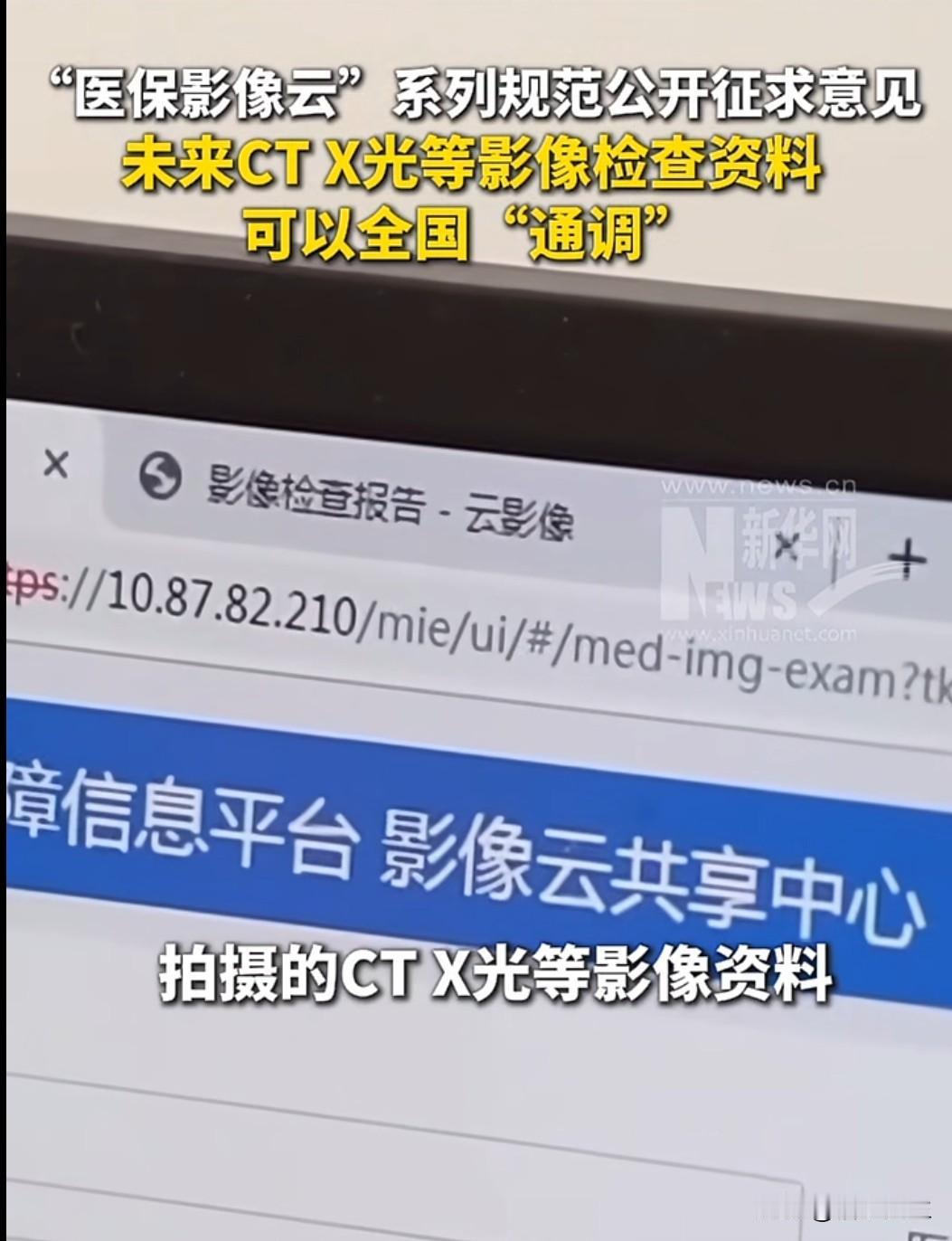 近日，医保局就四项