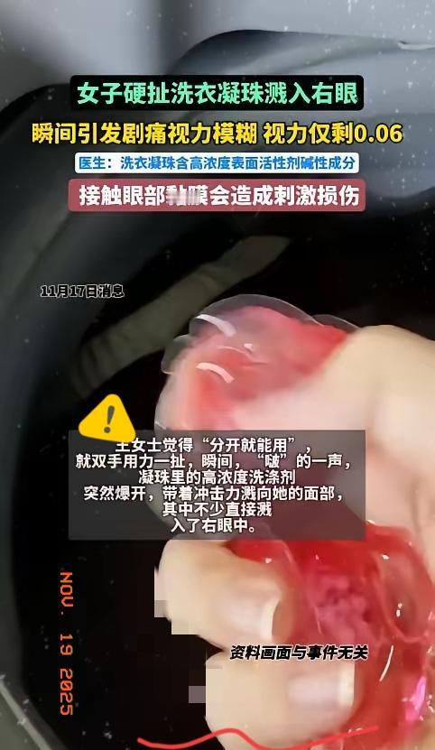 “悲剧还是发生了！”近日，浙江杭州，一女子洗衣服时，发现洗衣凝珠黏在了一起，她用