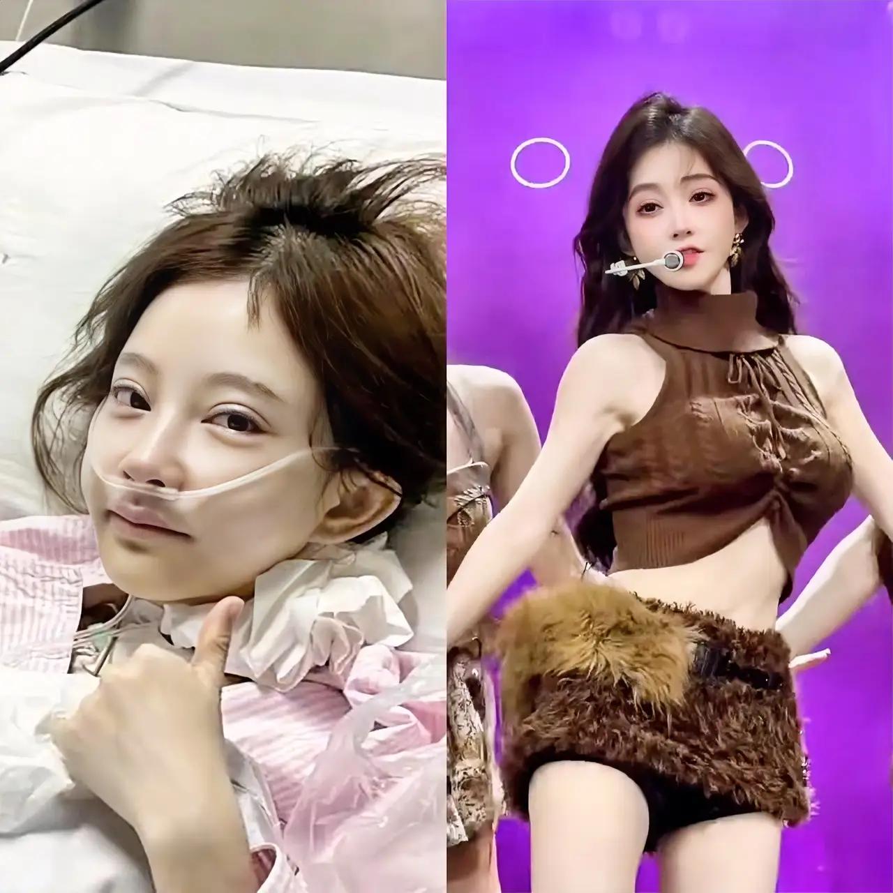 越有钱的人，真的越拼啊！不信你看千万网红冯提莫。34岁的她，已经患了两次癌症了，