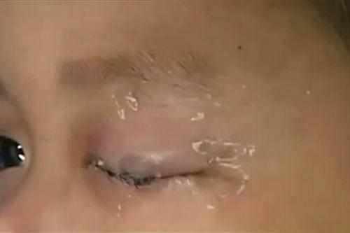儿子把502滴进女儿的眼里, 得知原因妈妈惭愧