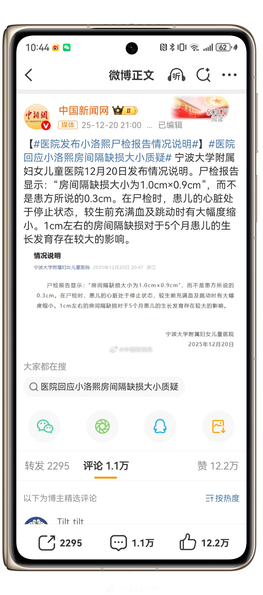 涉事医院回应小洛熙尸检报告前后矛盾了吧这个情况说明是质疑sj报告嘛？怎么又删了，