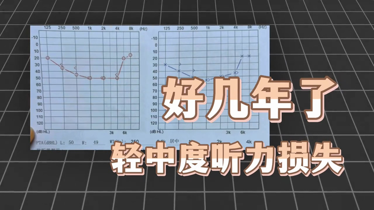 我的摄影师跟了我三年，我一直以为他是装没听见