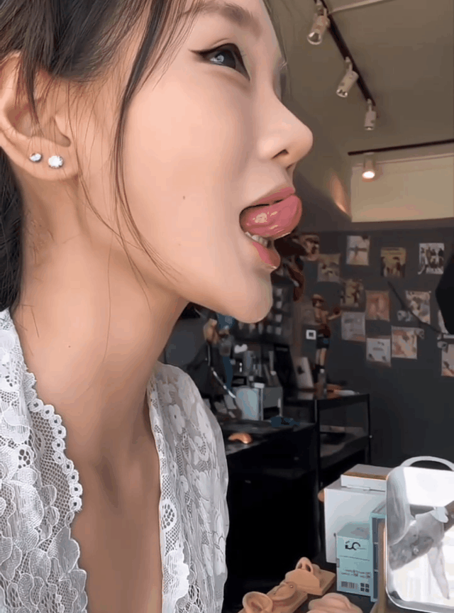 姑娘这舌苔泛白，病因是什么？