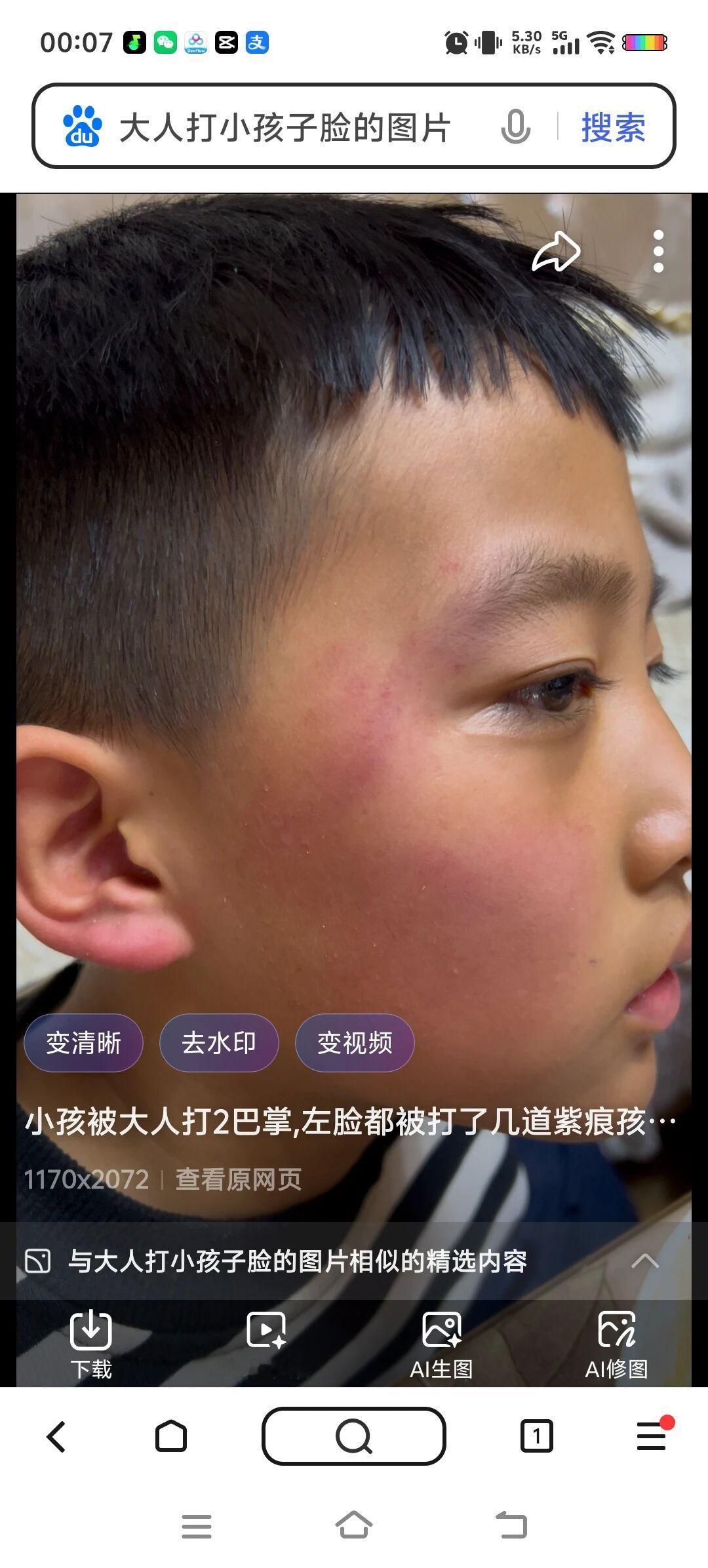 孩子在校被打，报警说轻微伤不立案？这样说立马解决——孩子在学校被打，警察一句