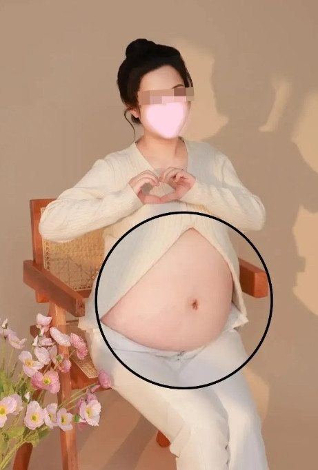 一觉醒来董小姐事件迎来了的一个好消息，一个坏消息好消息是国家卫健委开始调查，