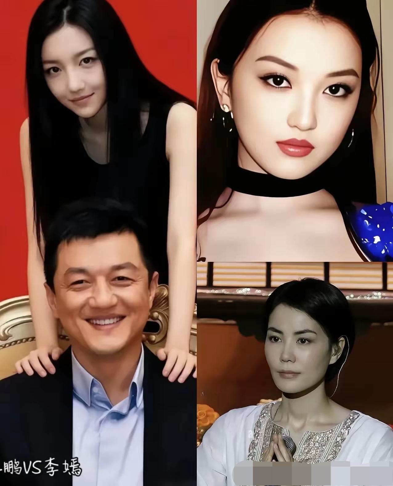 王菲女儿手术成功后真的很美，幸亏这种什么唇，只是基因突变不会遗传。