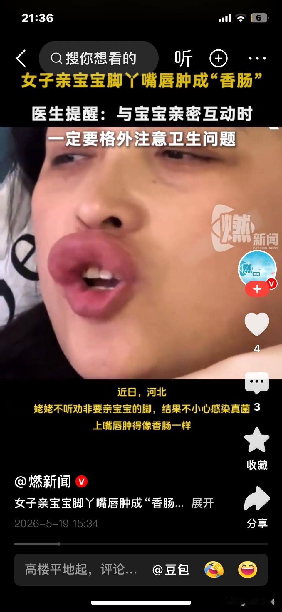 笑不活了！河北，姥姥来看外孙子坚持要亲一下外孙小脚丫，结果亲出香肠嘴！医生：脚气