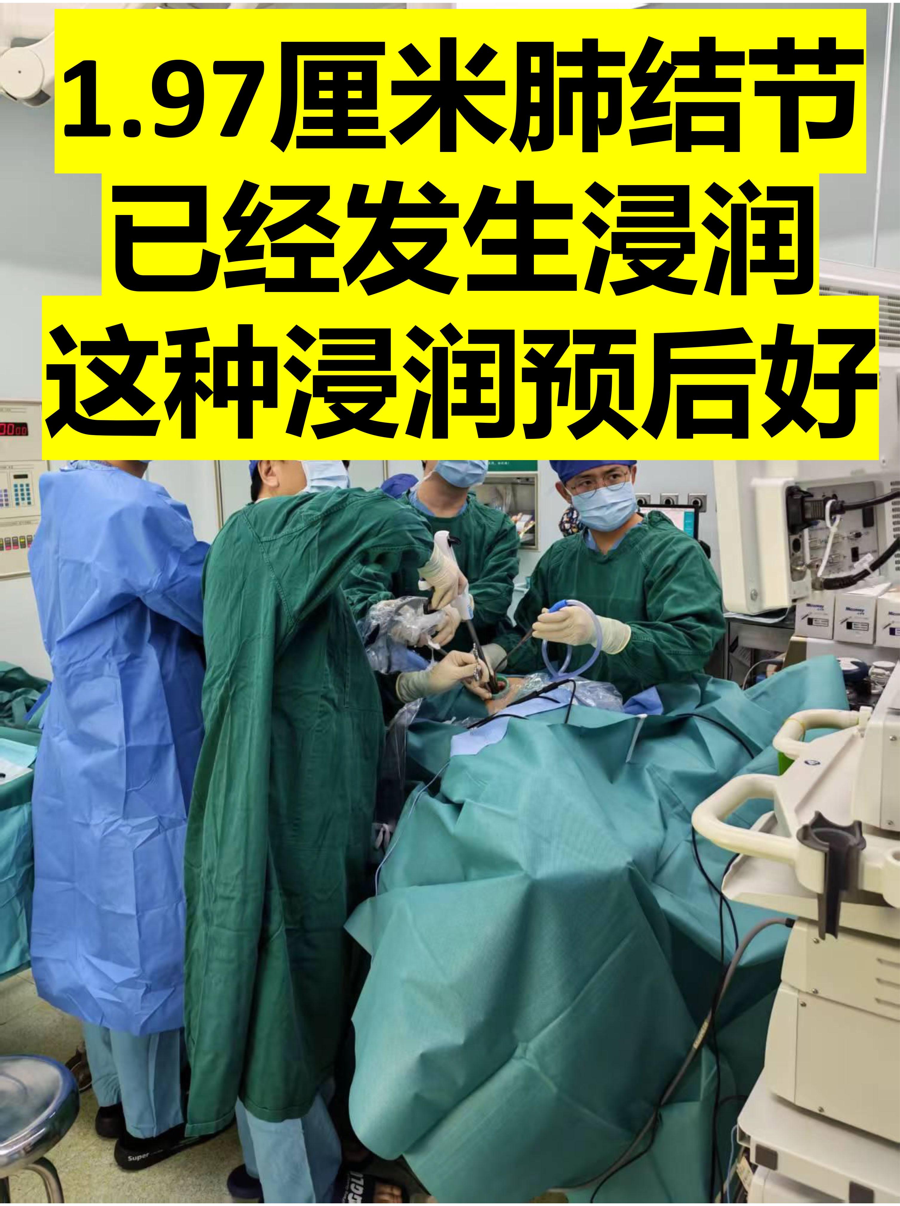 浸润性腺癌很多预后不好，但这种浸润预后好。周三上午出胸外科门诊，来了一...