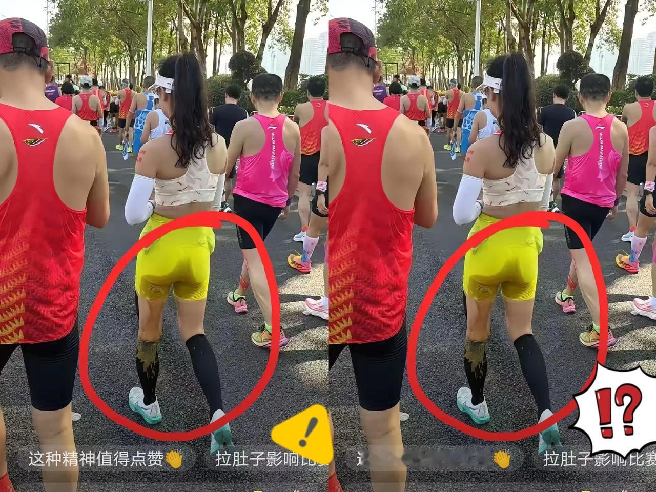城市马拉松上这幕真的又尴尬又让人肃然起敬！这位小姐姐奔着终点发力时突然急性肠炎