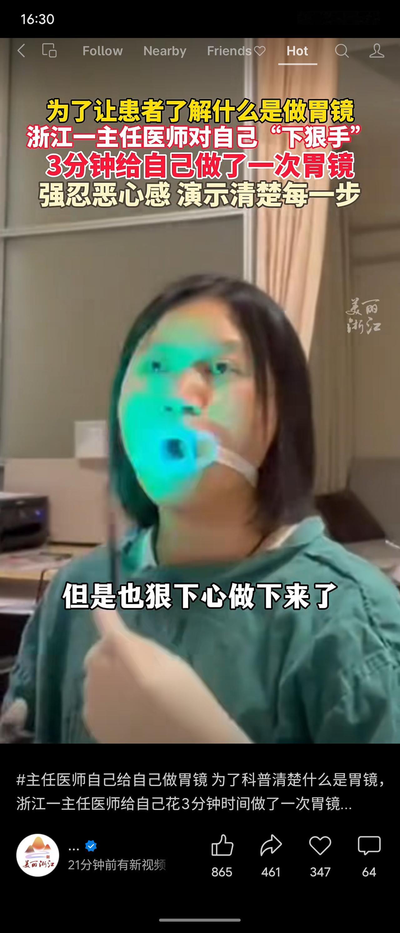 浙江一位主任医师为科普胃镜，亲自“下狠手”，用3分钟给自己做了一次胃镜。他强忍恶