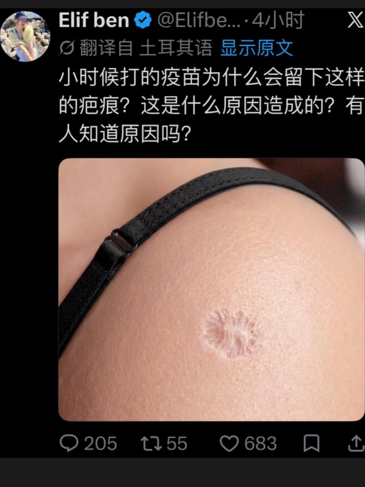 我们身体的白垩纪。