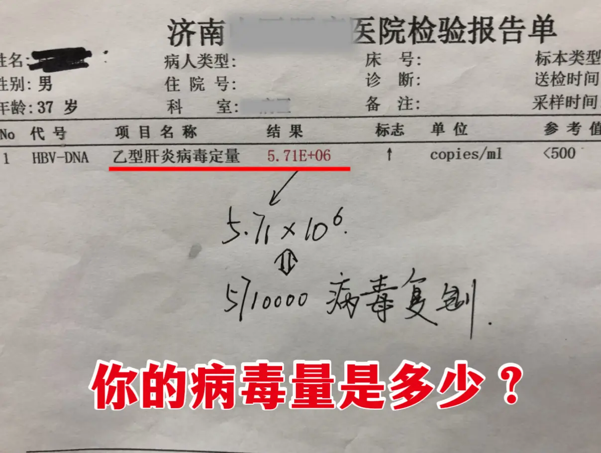 37 岁患者问 5.71E+06 病毒量到底有多高？对照看看你的病毒数...