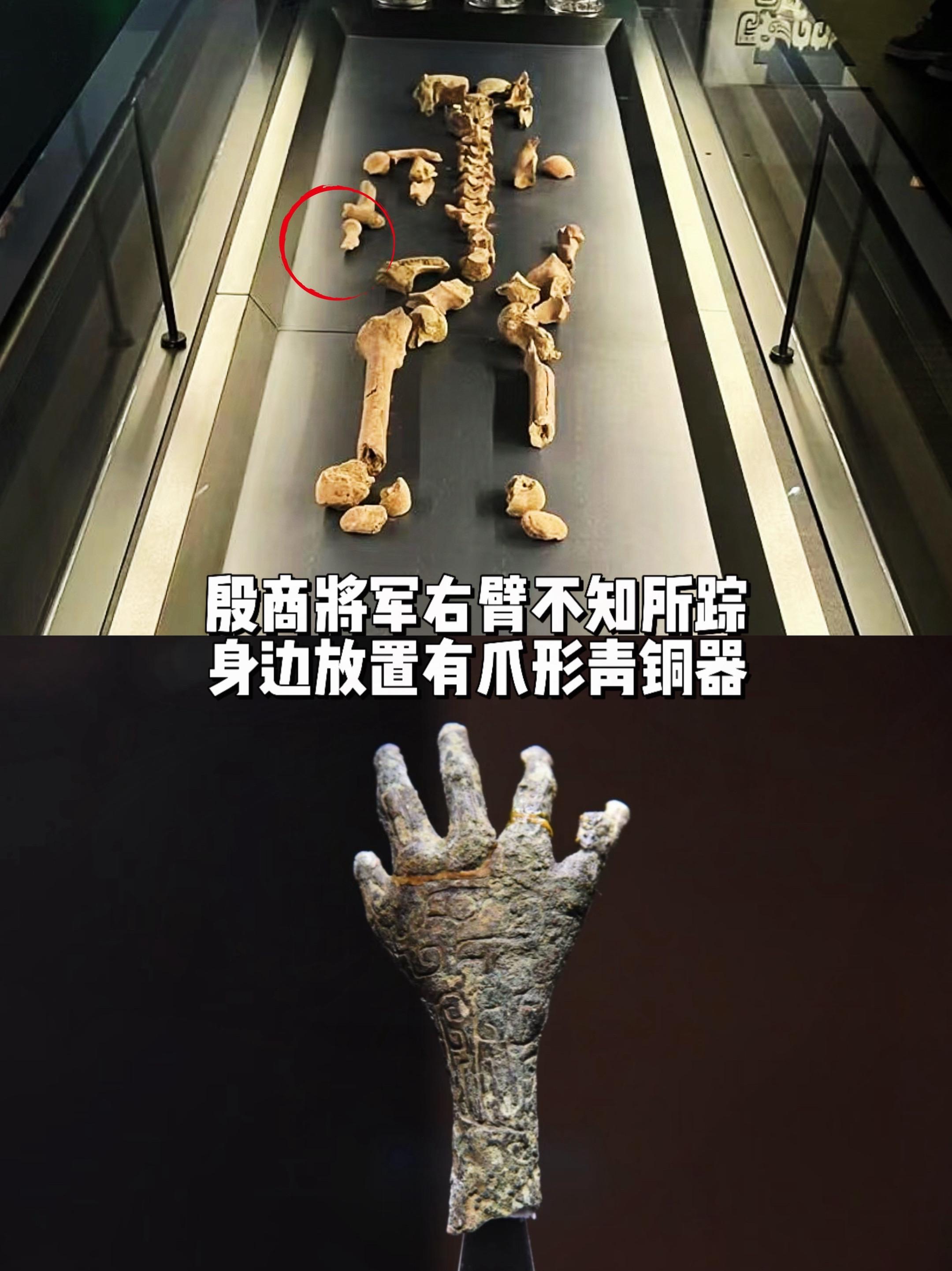 殷商将军右臂不知所踪，身边放置爪形器。2000年河南安阳花园庄村发现一...
