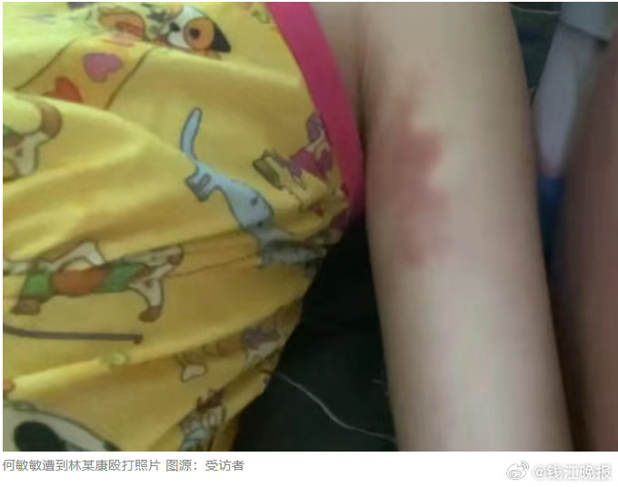 #双胞胎姐妹遭妹妹男友行凶1死1重伤#【广西21岁双胞胎姐妹遭妹妹男友行凶致1死