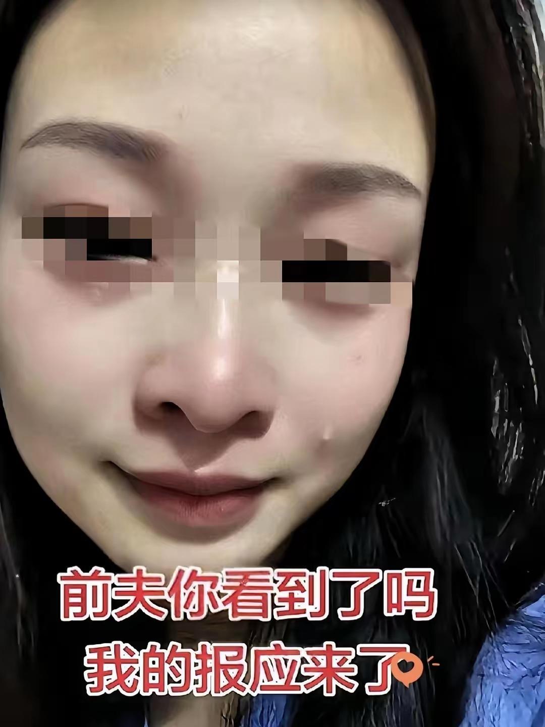 她当初不肯做鉴定，前夫怀疑也正常。手指扎一下的事，你越躲人越觉得心里有鬼。后来离