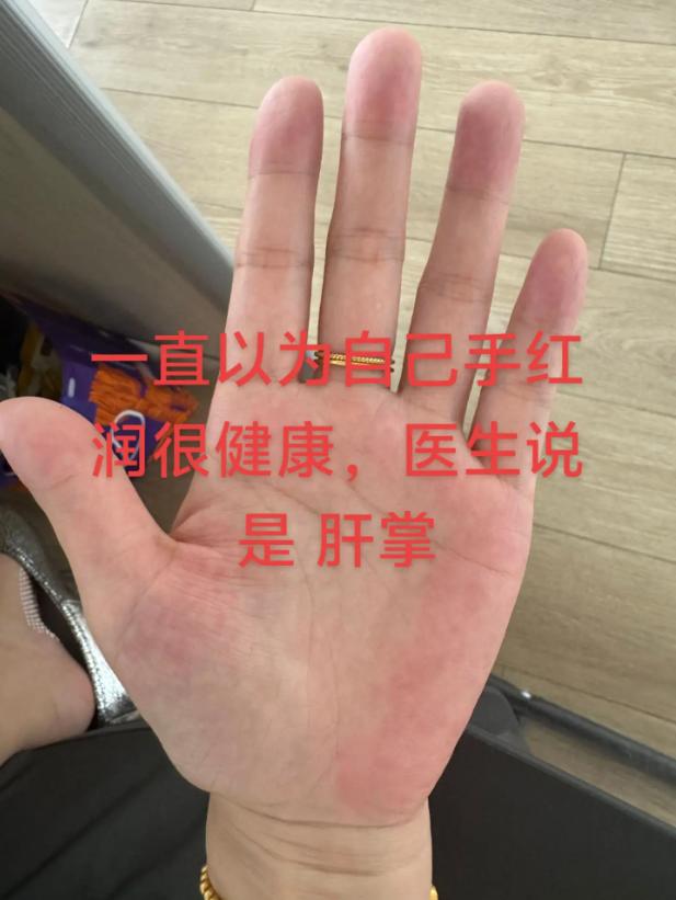 江苏一女子一直以为自己身体健康气血活络，直到5月27日看了医生，医生瞅了一眼她的