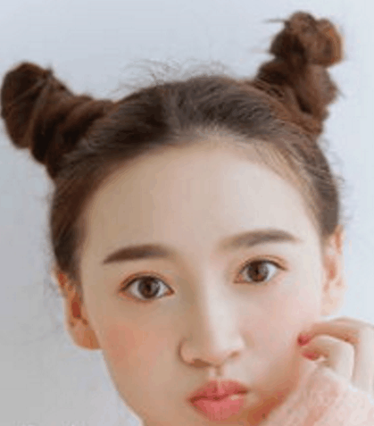 玫玫护肤;激素脸出现了红血丝, 角质层真的很薄要怎么办?
